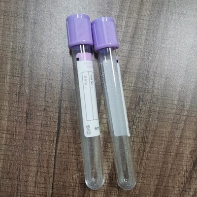 1ml - Lavender 10ml το τοπ αίμα σύρει την έγκριση CE σωλήνων για την ανάλυση κυττάρων αίματος