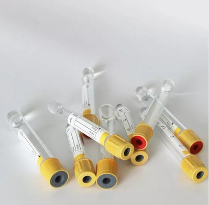 3 ml-10 ml Gel And Clot Activator Tube για εξετάσεις σακχάρου στο αίμα, χοληστερόλης και ουρικού οξέος