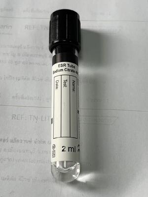 10,6 ml ESR σωλήνα κενού με 3,8% κιτρικό νατρίου για το ποσοστό ιζηματοποίησης