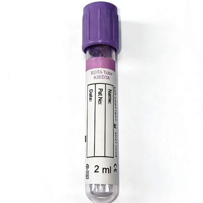 Πλήρους αίματος EDTA σωλήνες: Είναι απαραίτητο για την αιματολογία και την ακεραιότητα της μοριακής δοκιμής
